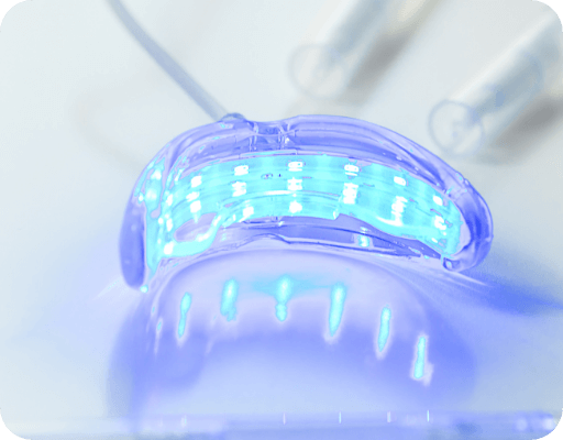 青いLEDライトが点灯したホワイトニング用マウスピース